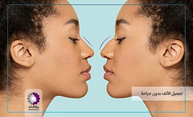 تصویر شاخص تجميل الأنف بدون جراحة