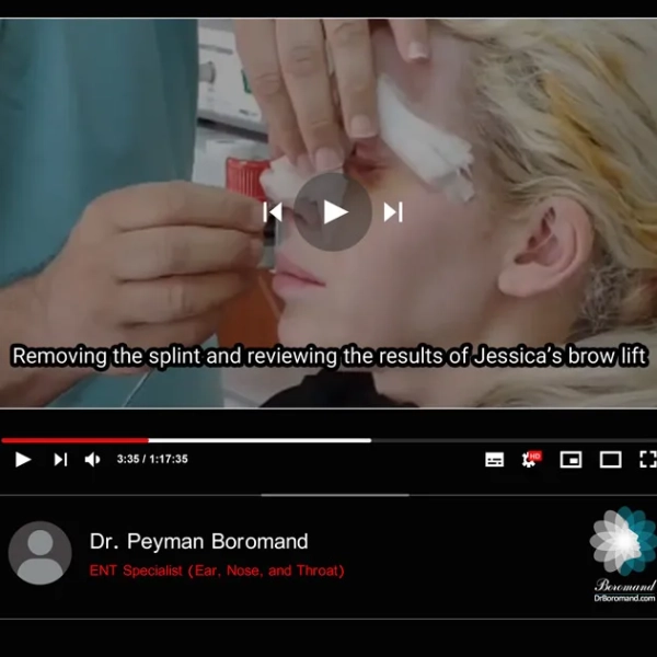 canadian-patient-1 en canadian-patient-1 en